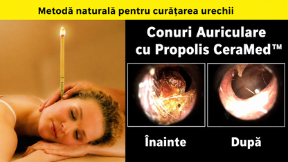 Conuri Auriculare cu Propolis CeraMed™